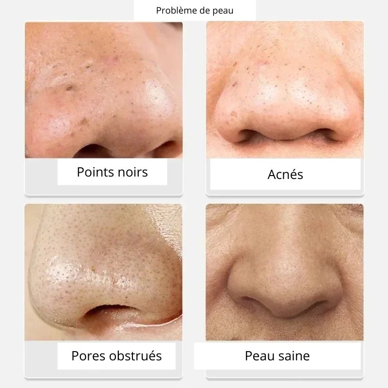 Masque anti points noirs LANBENA